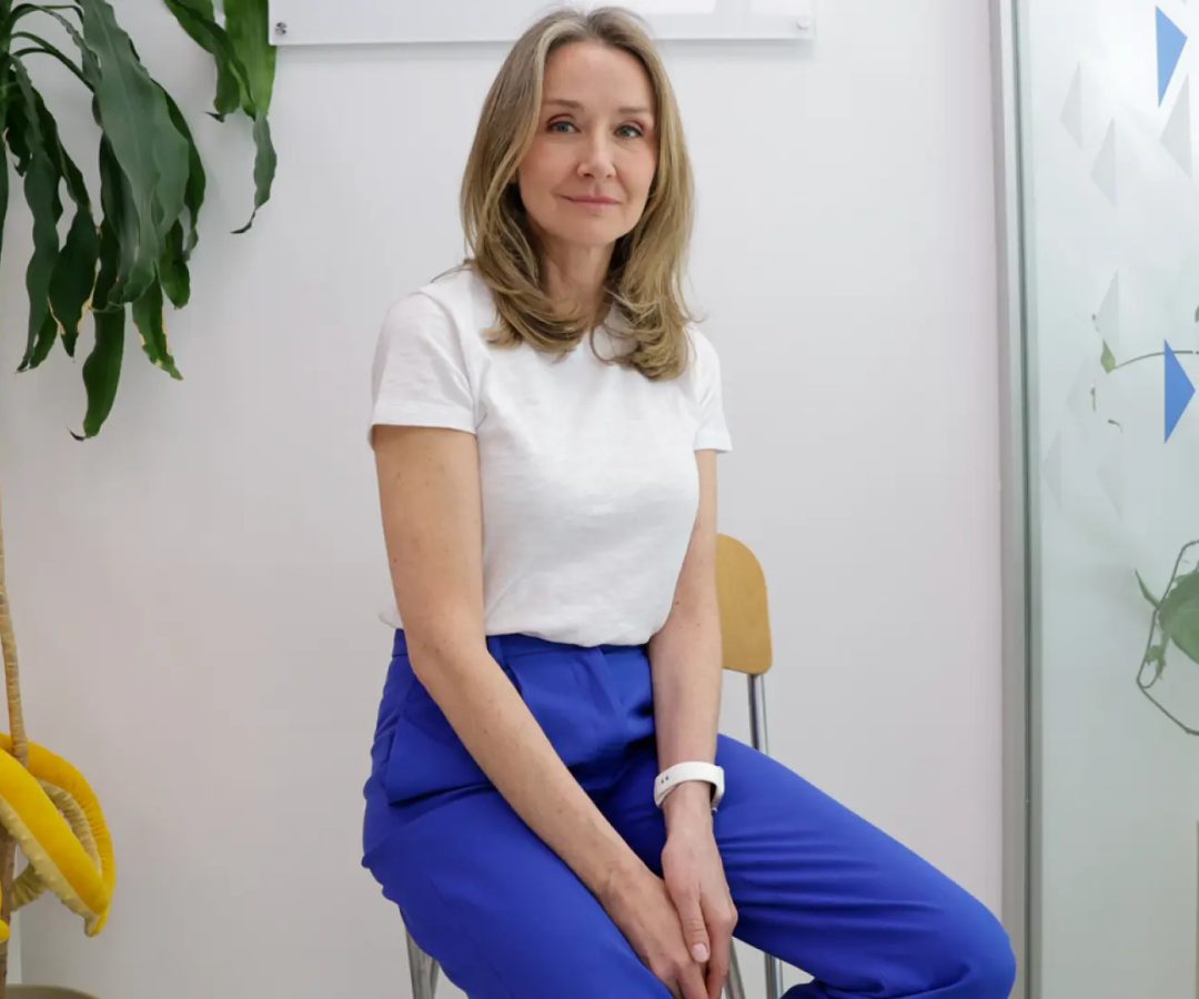 Conforme a los criterios de