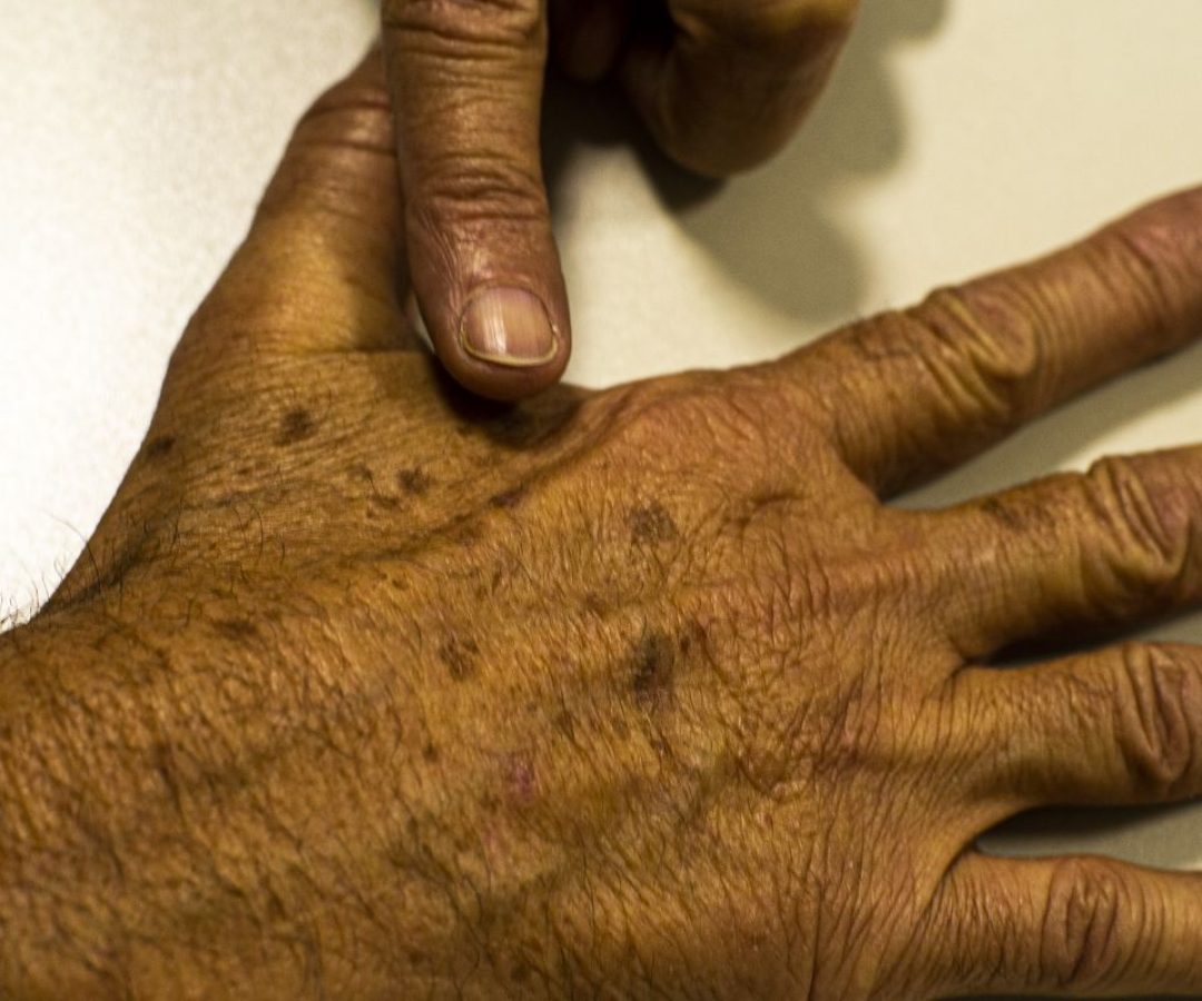 © Marcello Casal Jr/Agência Brasil/Arquivo