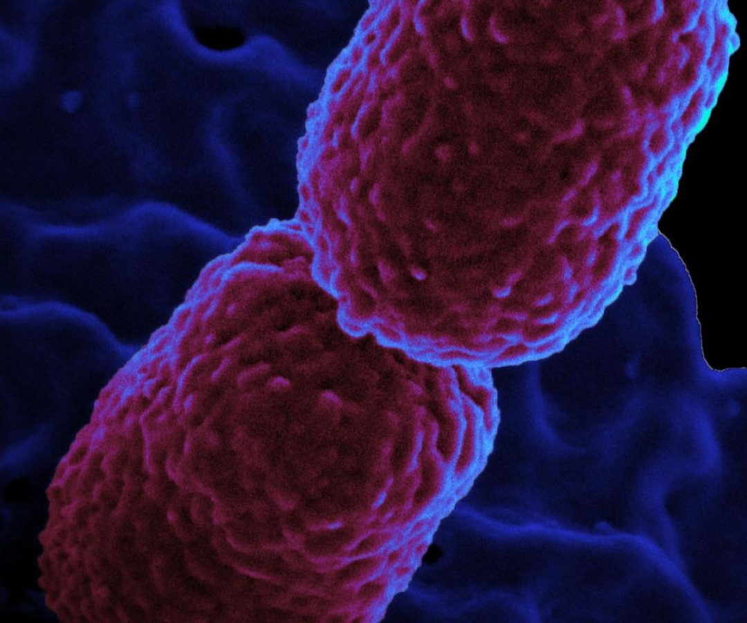 klebsiella_pneumoniae_bacterium_colorized_scanning_electron_micrograph_showing_carbapenem-resistant.jpeg