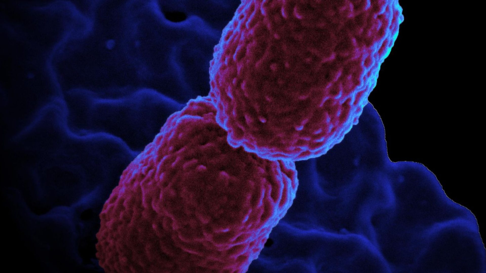 klebsiella_pneumoniae_bacterium_colorized_scanning_electron_micrograph_showing_carbapenem-resistant.jpeg
