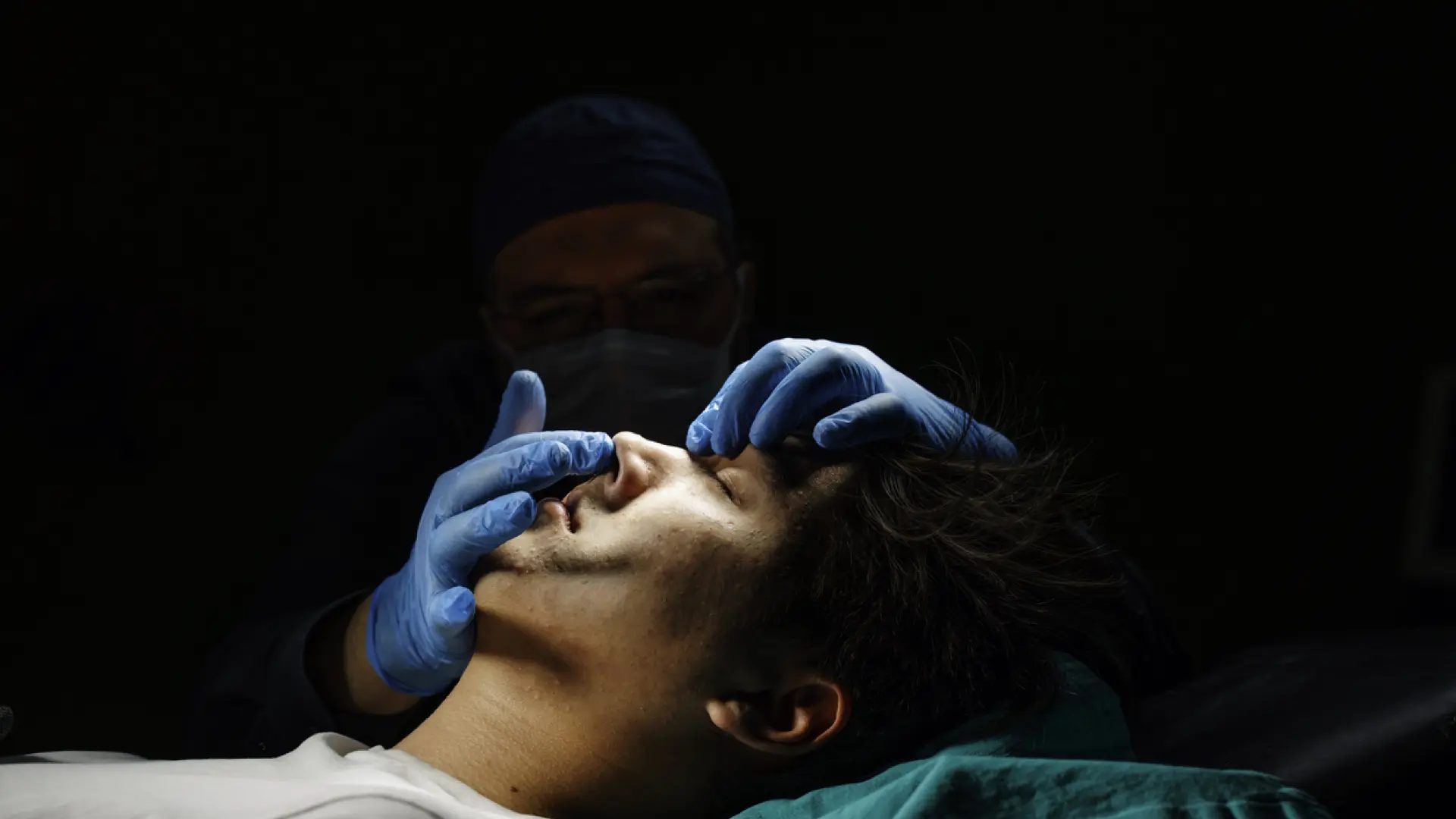 Rinoplastia, operación quirúrgica de la nariz.Resat Dongel